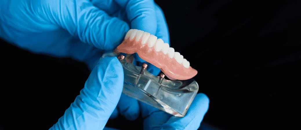 Gloved hands holding a partial denture