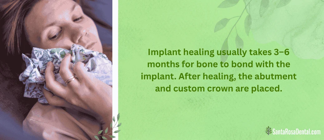 Infographic: implant healing usually takes 3 to 6 months before the abutment and custom crown are placed